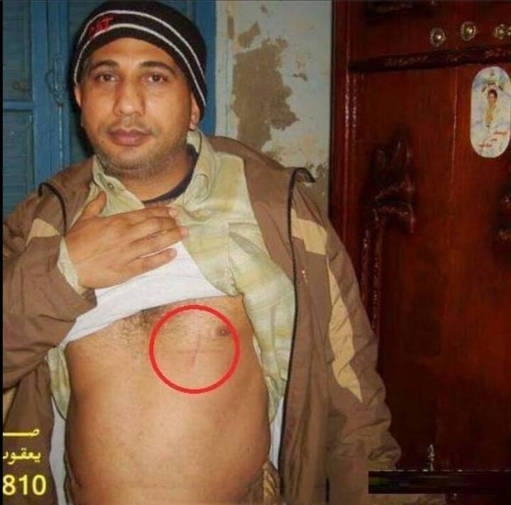 معجزة جميله جدا للبابا كيرلس والشهيد ابانوب