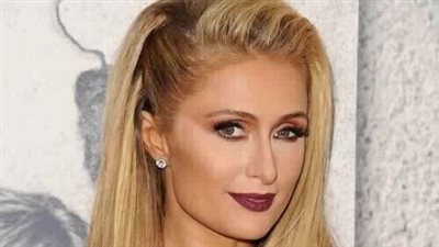 أشهر نجوم هوليوود الذي يعانون من تشوهات جسدية