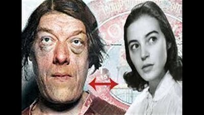 ابشع امرأه في العالم ..ملكة جمال الانسانيه