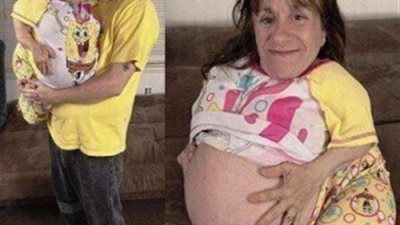 هذا الرجل اختار ان يتزوج من فتاة معاقة جسديا رغم تحذير الاطباء وكانت النتيجة