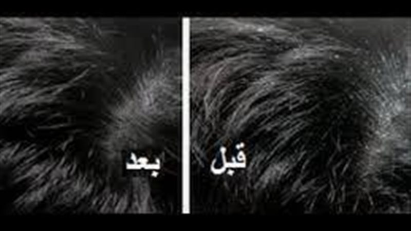 الحق والضلال