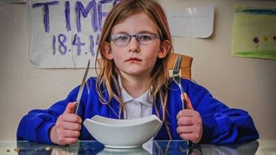 ​بالصور.. تعرف على اغرب متلازمات مرضية من بينها ” فتاة بريطانية لا تأكل ولا تنام ولا تشعر بالألم و قبيلة معدومة الأصابع الوسط”