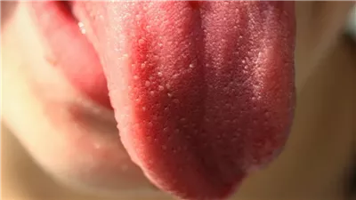 4 علامات لو ظهرت على لسانك فأنت مصاب بجلطة تابع التفاصيل