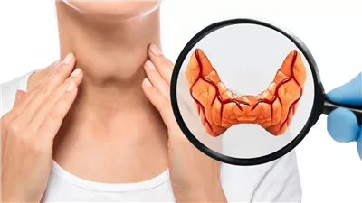 الحق شوف تحليلك كام خمول الغدة الدرقية قد ينهي حياتك