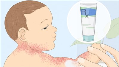 تأثير اهتمام الرجال ببشرتهم وعلاقته بمرض سرطان الجلد وتفاصيل الإصابة به 