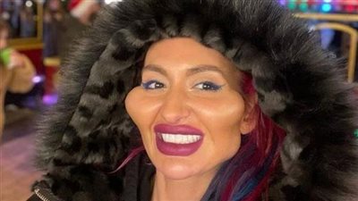 لن تتخيل كيف كان شكل صاحبة اكبر خدود قبل تشوية وجهها