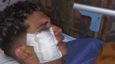 تفاصيل واقعة طالب التجمع المرعبة والتقرير الطبي الخاص به