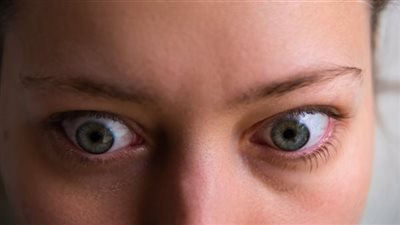 فنانة مشهورة تدخل الحزن لقلوب محبيبها بعد الإعلان عن إصابتها بمرض خطير اعرف اعراضه