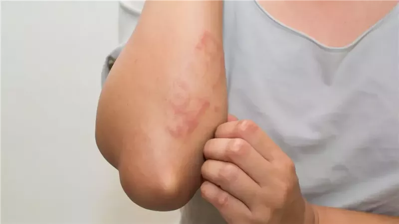 اعرف تفاصيل إصابة
