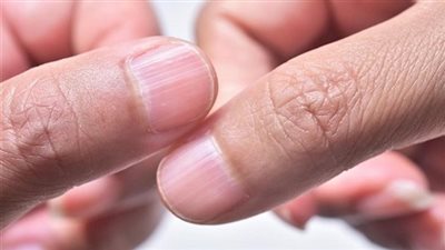 عشان تحمى قلبك وتحافظ على نسبة الكوليسترول تجب تلك العادات الخمسة فورا صباحا