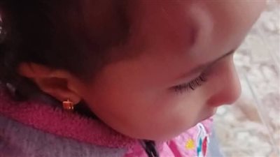 اللهم انى صائم....رجل يفتح دماغ طفلة فى حضانة بطوبة عشان بتاكل فى نهار رمضان وردود فعل قوية على الواقعة