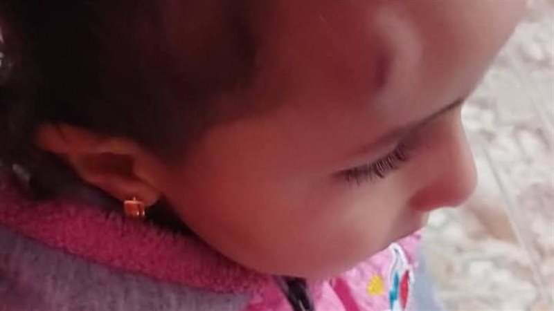 رجل يفتح دماغ طفلة