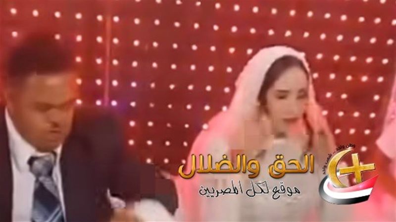 فرح عريس متلازمة