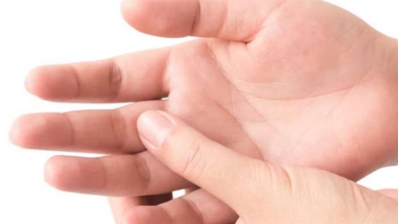اصفرار الأظافر علامة