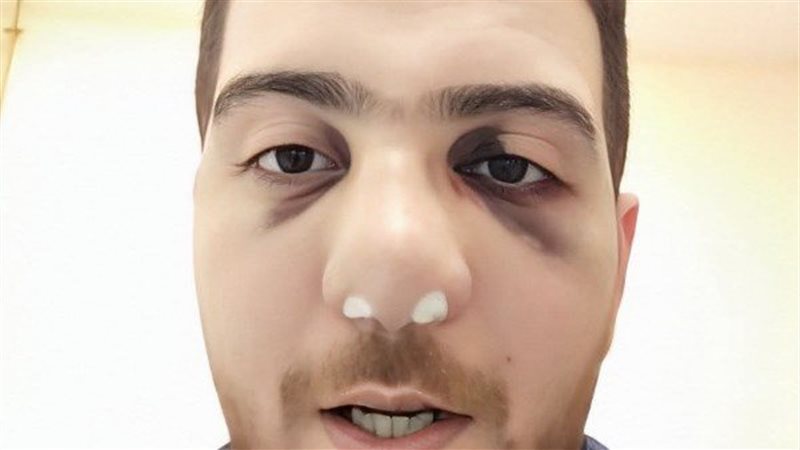  مستشفى الباجور