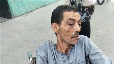 تفاصيل الحالة الصحية لمسن حلوان 