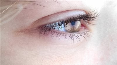 هذه العادات تسبب انتفاخ العيون احذري منها