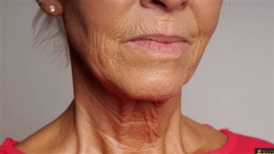 تخلصي من تجاعيد الرقبة بخطوات بسيطة