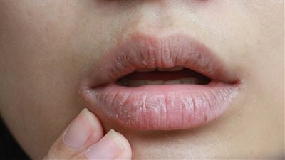 ماذا يفعل اللعاب في فمك احذر من ظهور هذه العلامة عند الاستيقاظ من النوم