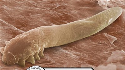 خلي بالك من الحشرات اللي على وشك طريقة التخلص من حشرات الوجه التي لا تري بالعين المجردة