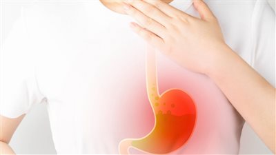 أحترس هذه الأعراض تكشف أصابتك بارتجاع المريء