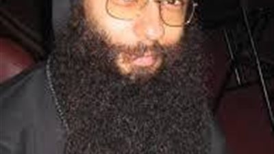 معجزة قوية للقديس سمعان ..جراحة شريان فى الساعد الأيسر