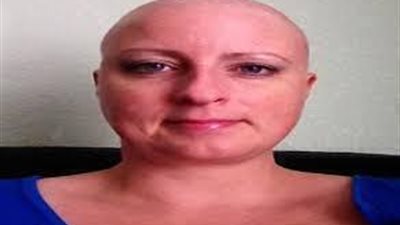 بالصورة ..صلوا من أجل هذه السيدة التي تعاني من السرطان