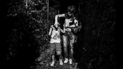 بالصور ..طفل يعيش بالظلام بسبب مرض جلدي نادر