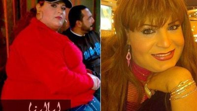 هل تذكرون الفنانة نورا السباعي ؟ شاهدوا صورها بعد فقدانها 75 كيلو من وزنها.. فرق لا يصدق!