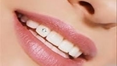 احصلي على ابتسامة ناصعة البياض مع وصفة طبيعية