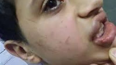 بالفيديو ..مدرس سلفي يصفع تلميذاً على وجهه بالقلم بمدرسة لغات