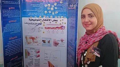 فتاة مصرية تكتشف مادة لعلاج سرطان الثدى