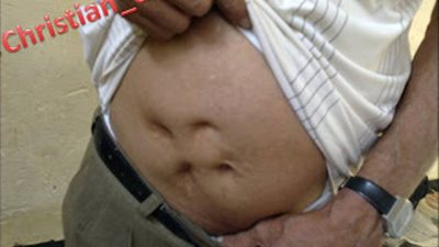 كان يعاني من سرطان على الكلى والشرج لكن ببركة الأم تماف ايريني والبابا كيرلس عملوله العملية واخدت شكل صليب