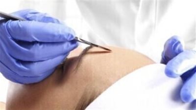 بعد مواقف محرجة ليلة الزفاف.. توأمان يجريان عمليات تجميل لتجنب الخلط في الزوجات