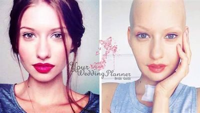 عارضة ازياء اصيبت بالسرطان وتم ولادة ابنها قيصرياً ..شاهد ماذا فعل زوجها معها بعد كل ذلك