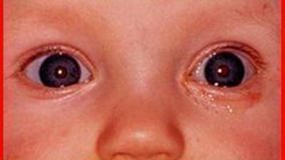 تحذير لجميع الاباء والامهات انتهبو لمثل هذه الالعاب التي تسبب فقدان البصر لاولادكم