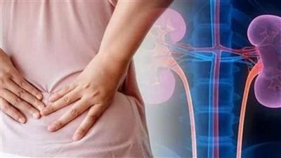 عشان تحافظ على كليتك اعرف أسباب الحصوات وطرق الوقاية