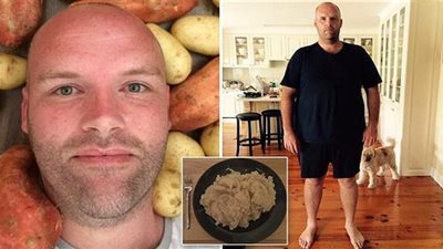 رجل يخسر 30 كيلو من وزنه بسبب تناوله البطاطا فقط
