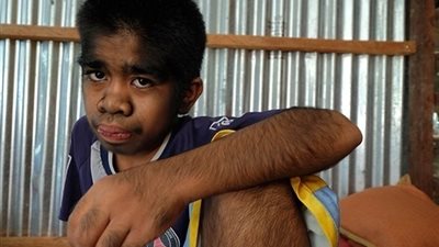 الطفل الذئب يكشف ..بعض الناس يضحكون في وجهي وأخرون يطلبون المباركة