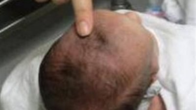 احذروا لمس رأس الطفل حديث الولادة