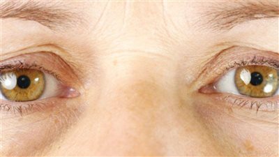 عندك هالات سوداء وتعبتي من الكريمات مفيش غير اجة وحادة هتخلصك منها نهائيا اعرفيها بالتفاصيل