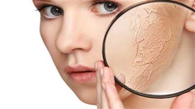 بشرتك جافة هنقولك على 5 خطوات فعالة للتفادي الجفاف في فصل الشتاء