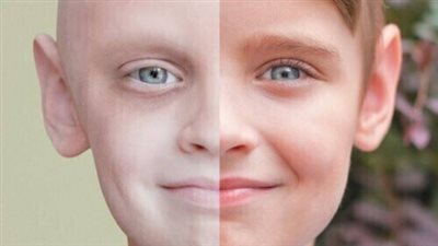 علامات إذا ظهرت عليك تنذرك بالإصابة بـ «السرطان» ويجب عمل الفحوصات فوراً