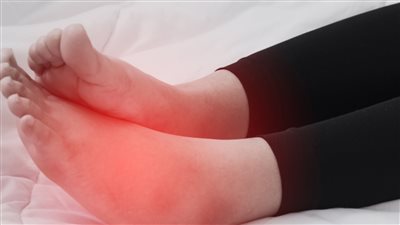 5 علامات خطيرة لارتفاع الكوليسترول تظهر على قدميك فاحذرها