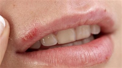 8 عادات صحية التزم بها للحفاظ على صحة اسنانك