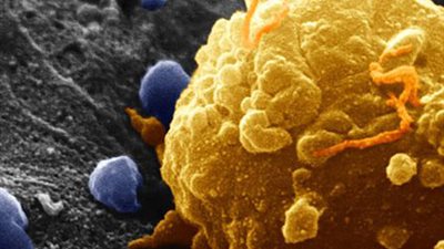 هناك سبع مؤكولات من اكثر اسباب انتشار السرطان هذه الايام