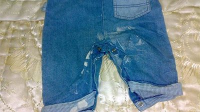 حل سحرى لإخفاء بقع الكلور من على الملابس