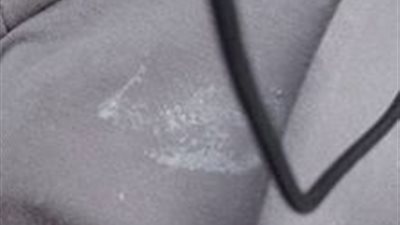 النهاردة و انا بركب الصبح من مريوطية رايحة الشغل ف المعادى .جت بنت وقفت جمبى و الدنيا كانت زحمة و ناس كتير اوى مره واحدة بحط إديا ع جمبى لقيت كريم او حاجه شبهه اوى ع هدومى 1082490