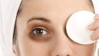 بثلاث مكونات طبيعية يمكنك القضاء علي الهالات السوداء حول العين ونتيجته مؤكده وفعالة