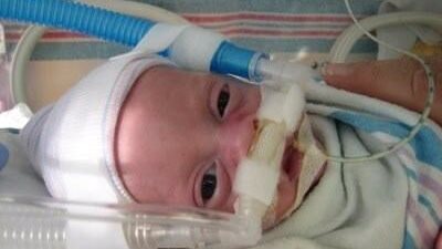 الطفل ماثيو عمره 9 شهور يشفي من ضيق حاد في التنفس بمعجزة عجيبة